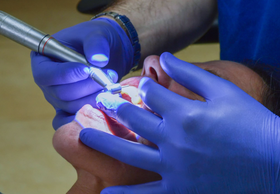 Close-up of a patient receiving a dental filling procedure