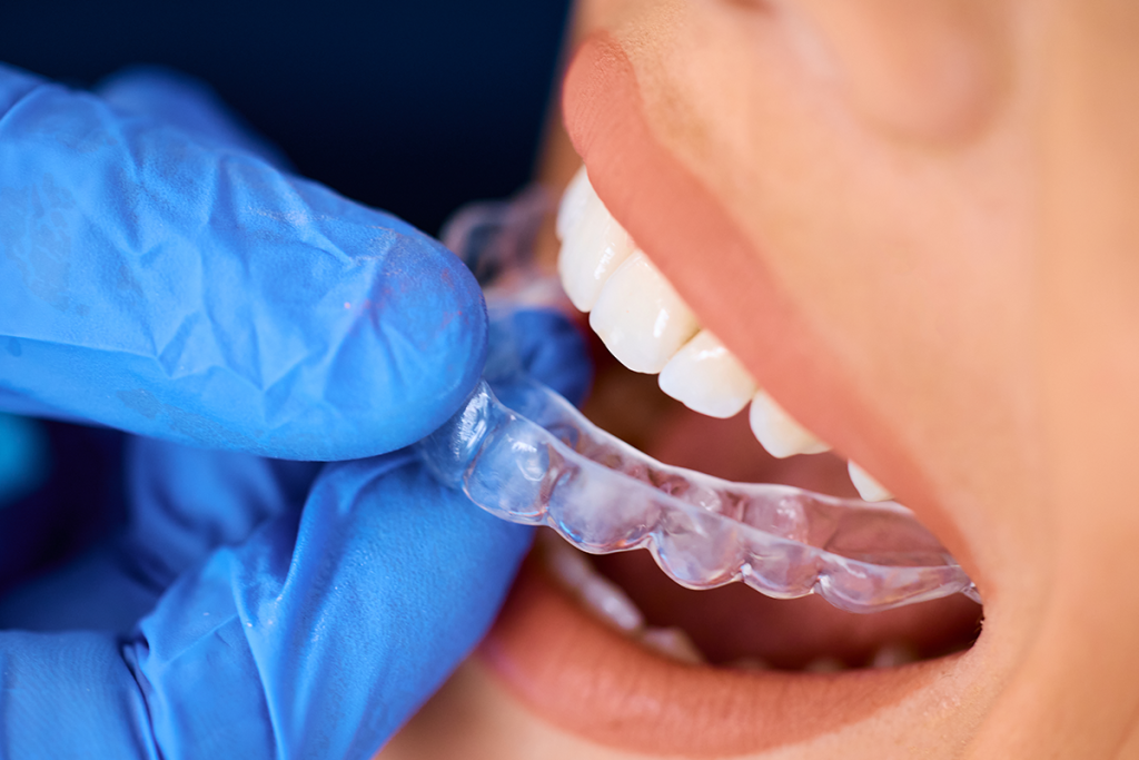 Invisalign Services at Las Palmas Dental