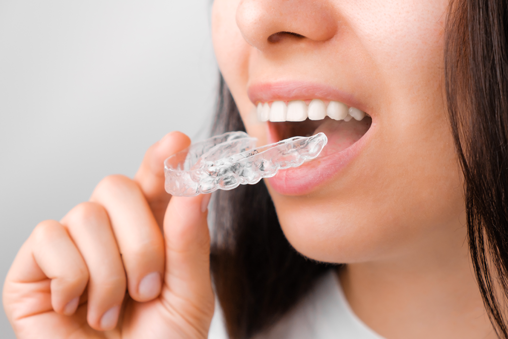 Invisalign at Las Palmas Dental