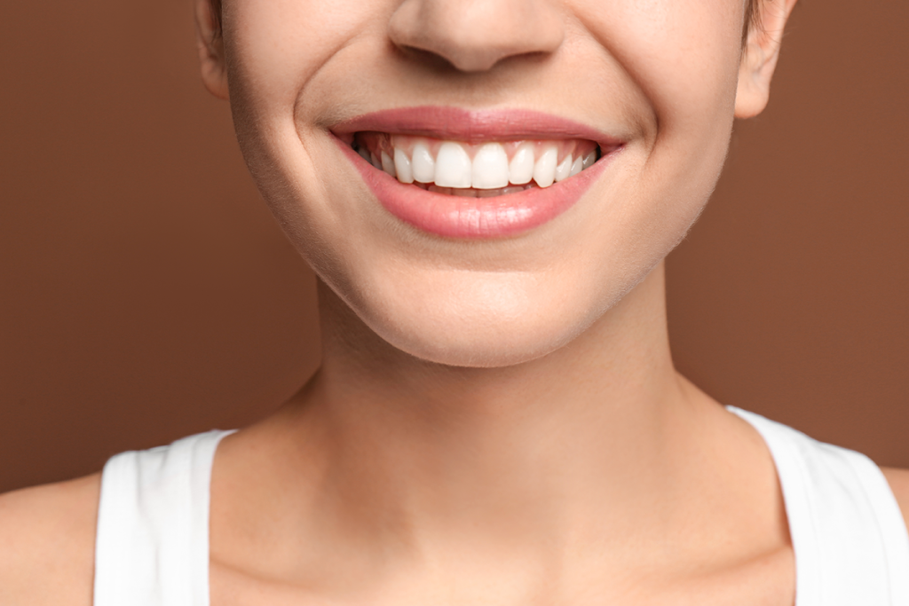 Las Palmas Dental Teeth Whitening