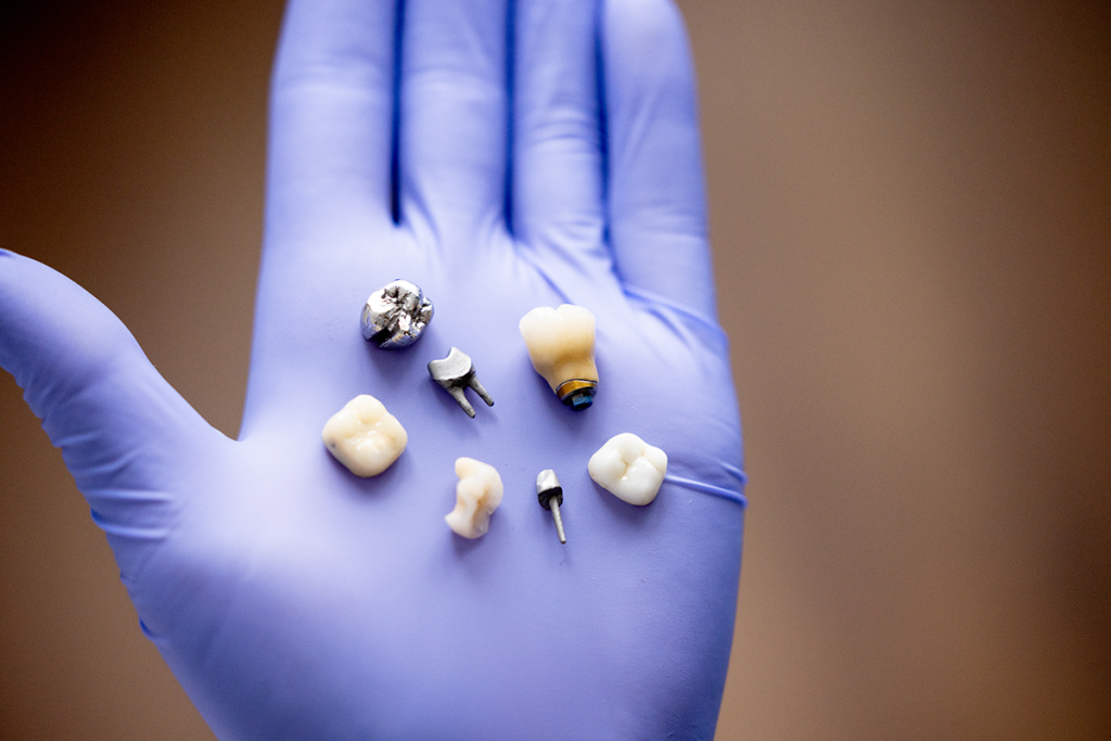Dental Crowns at Las Palmas Dental