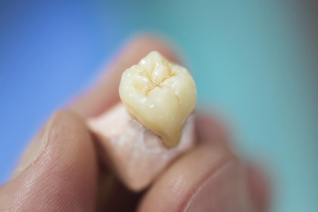 Dental Crowns Services