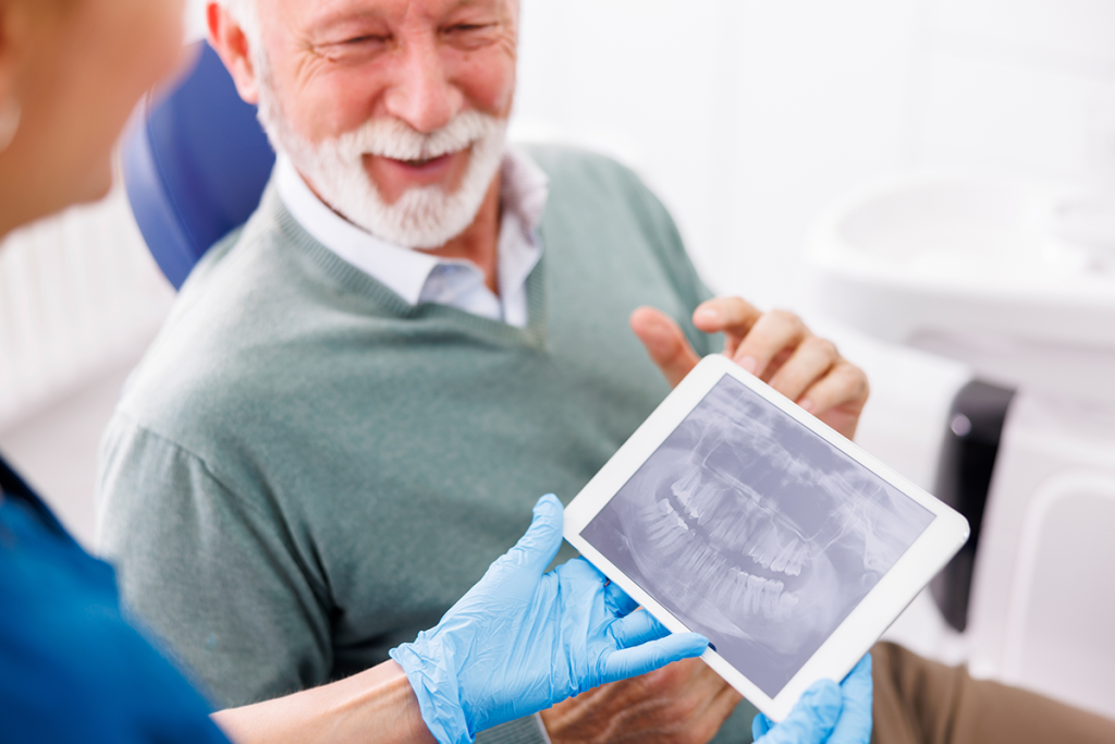 Dental Implant Options