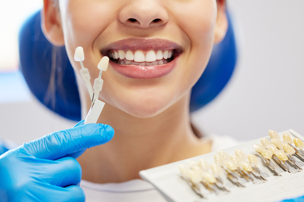 Veneers at Las Palmas Dental