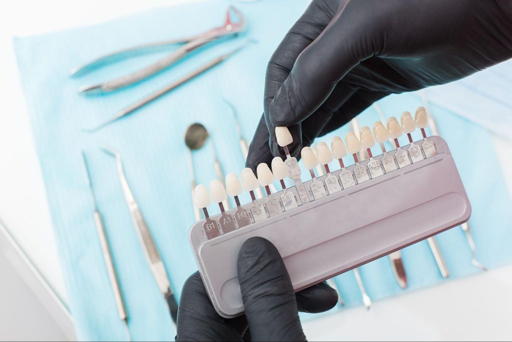 Dentist’s black-gloved hand selecting a tooth shade for a dental crown with tools in the background